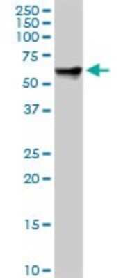 Western Blot: Radixin Antibody (1E12) [H00005962-M01]
