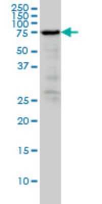 Western Blot: Radixin Antibody (1F6) [H00005962-M03]