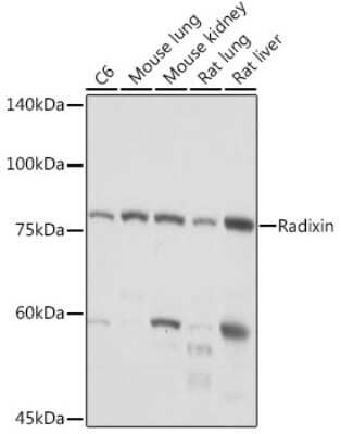 Western Blot: Radixin Antibody (4U6W9) [NBP3-15894]