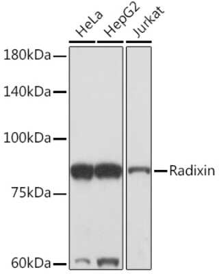 Western Blot: Radixin Antibody (4U6W9) [NBP3-15894]