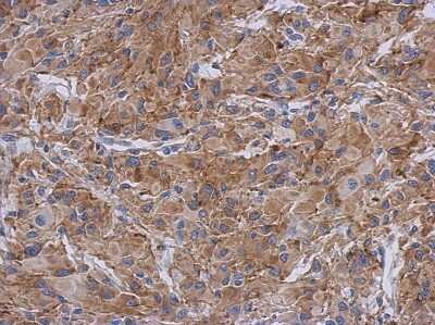Immunohistochemistry-Paraffin: Radixin Antibody [NBP1-31553]