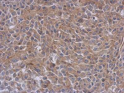 Immunohistochemistry-Paraffin: Radixin Antibody [NBP1-31553]