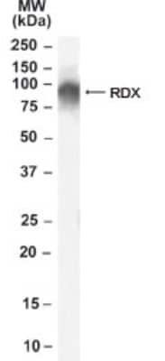 Western Blot: Radixin Antibody [NB100-41100]