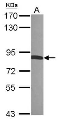 Western Blot: Radixin Antibody [NBP1-31553]