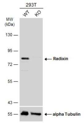 Western Blot: Radixin Antibody [NBP1-31553]