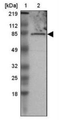 Western Blot: Radixin Antibody [NBP1-85238]