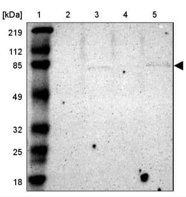 Western Blot: Radixin Antibody [NBP1-85239]