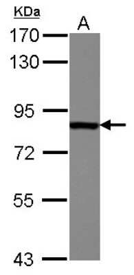 Western Blot: Radixin Antibody [NBP2-20063]