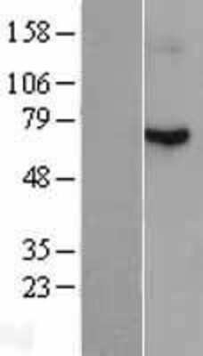 Western Blot: Radixin Overexpression Lysate [NBL1-15261]