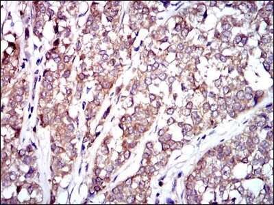 Immunohistochemistry: Raf-1 Antibody (4G4) - BSA Free [NBP2-37513]