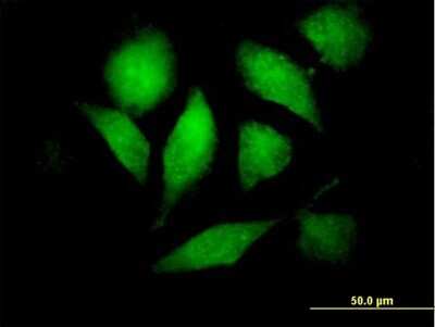 Immunocytochemistry/ Immunofluorescence: Raf-1 Antibody [H00005894-B01P]