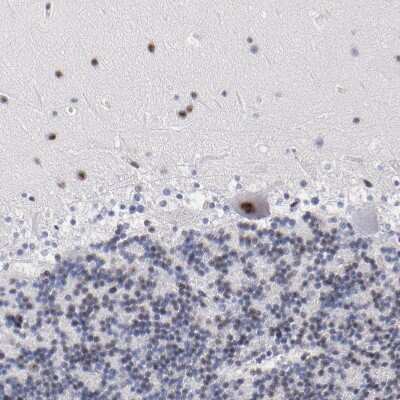 Immunohistochemistry-Paraffin: Raf-1 Antibody [NBP1-85462]