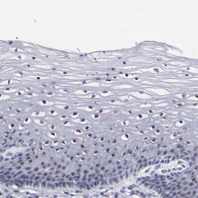 Immunohistochemistry-Paraffin: Raf-1 Antibody [NBP1-85462]
