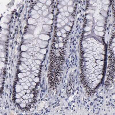 Immunohistochemistry-Paraffin: Raf-1 Antibody [NBP1-85462]