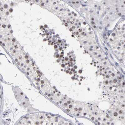 Immunohistochemistry-Paraffin: Raf-1 Antibody [NBP1-85462]