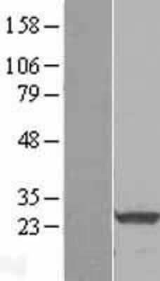 Western Blot: RalA/RalB Overexpression Lysate [NBL1-15130]