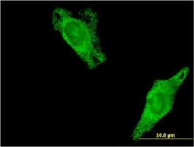 Immunocytochemistry/ Immunofluorescence: RalA/RalB Antibody (3E6) [H00005898-M01]