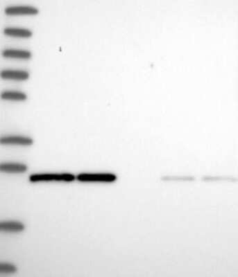 Western Blot: RalA/RalB Antibody [NBP3-17302]