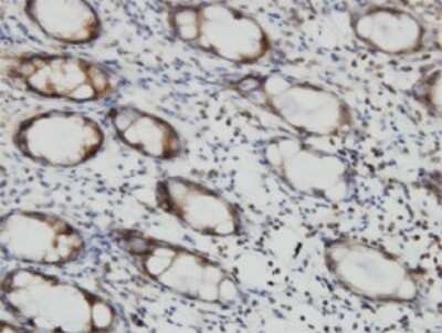 Immunohistochemistry-Paraffin: RalB Antibody (4D1) [H00005899-M04]