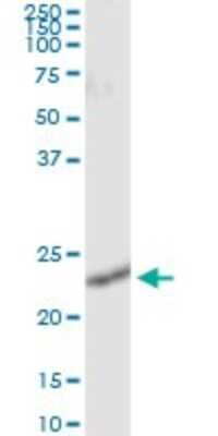 Immunoprecipitation: RalB Antibody (4D1) [H00005899-M04]