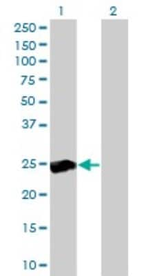 Western Blot: RalB Antibody (4D1) [H00005899-M04]