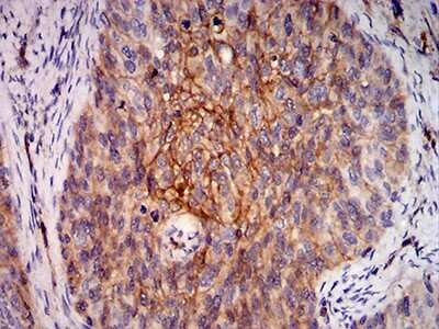 Immunohistochemistry: RalB Antibody (7F8B4) - BSA Free [NBP2-61831]