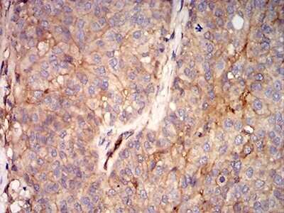Immunohistochemistry: RalB Antibody (7F8B4) - BSA Free [NBP2-61831]