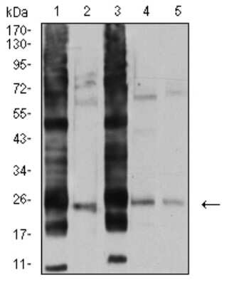 Western Blot: RalB Antibody (8A8A9)BSA Free [NBP2-61826]