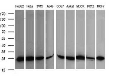 Western Blot: RalB Antibody (OTI2C4)Azide and BSA Free [NBP2-73785]