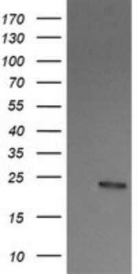 Western Blot: RalB Antibody (OTI2C4)Azide and BSA Free [NBP2-73785]