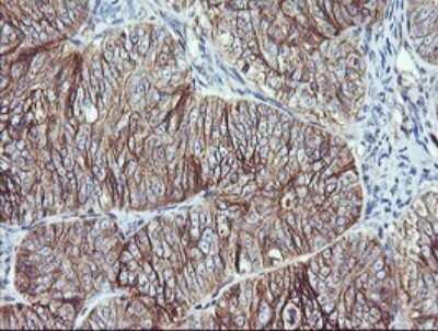 Immunohistochemistry: RalB Antibody (OTI2C4) [NBP2-45927]