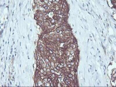 Immunohistochemistry: RalB Antibody (OTI2C4) [NBP2-45927]