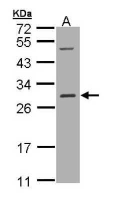 Western Blot: RalB Antibody [NBP1-32696]