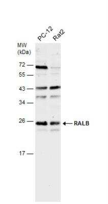 Western Blot: RalB Antibody [NBP1-32696]