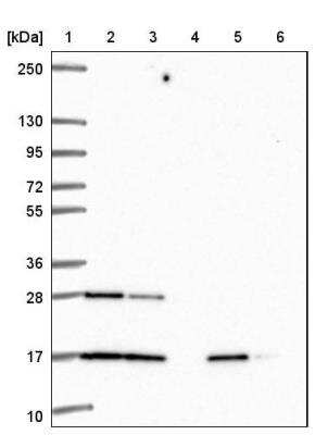 Western Blot: RalA Antibody [NBP2-46872]