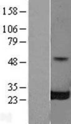 Western Blot: RalB Overexpression Lysate [NBL1-15131]