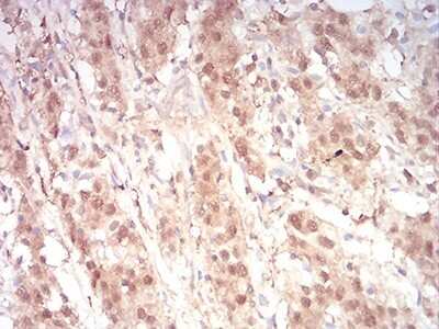Immunohistochemistry: Ran Antibody (8D1A6) - BSA Free [NBP2-61832]