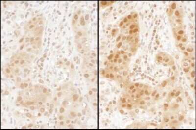 Immunohistochemistry: Ran Antibody [NBP2-32280]