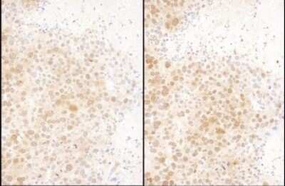 Immunohistochemistry: Ran Antibody [NBP2-32280]