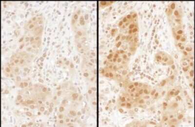 Immunohistochemistry: Ran Antibody [NBP2-32281]