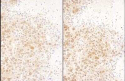 Immunohistochemistry: Ran Antibody [NBP2-32281]