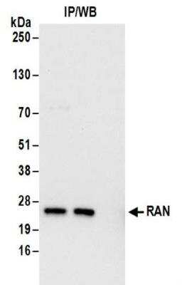 Immunoprecipitation: Ran Antibody [NBP2-32280]