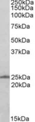 Western Blot: Ran Antibody [NB100-1442]