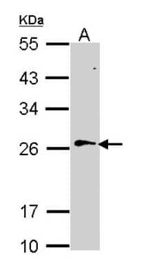 Western Blot: Ran Antibody [NBP1-31776]
