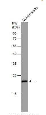 Western Blot: Ran Antibody [NBP1-31776]