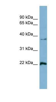 Western Blot: Ran Antibody [NBP1-58107]