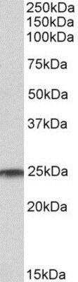 Western Blot: Ran Antibody [NBP1-68870]