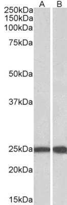 Western Blot: Ran Antibody [NBP1-68870]