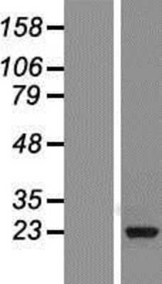 Western Blot: Ran Overexpression Lysate [NBP2-07637]