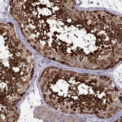 Immunohistochemistry-Paraffin: RanBP1 Antibody [NBP2-57339]